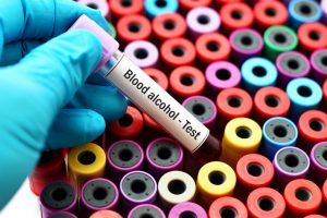 Determine the condition of the blood sample for DWI / DUI alcohol testing 