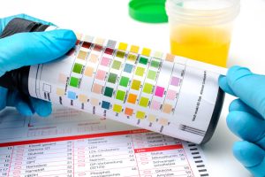 Child Custody Attorneys Handling Drug Testing in Passaic County, NJ