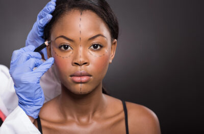 How Cosmetic Surgery Affects Your New Jersey Divorce Settlement